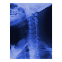 2 radiografiados - Azul electromágnetico Postales