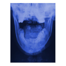 3 radiografiados - Azul electromágnetico Postales