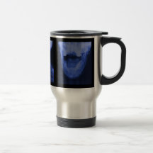 3 radiografiados - Azul electromágnetico Taza