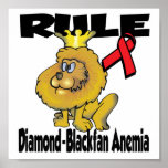 Anemia del Diamante-Blackfan de la regla Impresiones