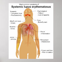 Carta del síntoma de eritematoso de lupus sistémic posters