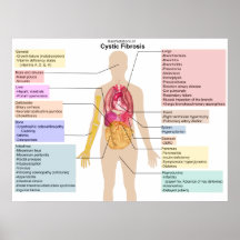 Carta detallada de los síntomas de la fibrosis quí impresiones
