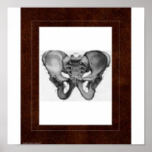Casa del alcohol de la pelvis poster