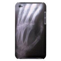 CASO del TACTO de IPOD de la radiografía de la man iPod Case-Mate Cárcasa
