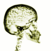 CEREBRO DEL CRÁNEO DE LA RADIOGRAFÍA - AMARILLO ESCULTURAS FOTOGRÁFICAS