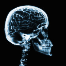 CEREBRO DEL CRÁNEO DE LA RADIOGRAFÍA - AZUL ESCULTURAS FOTOGRAFICAS