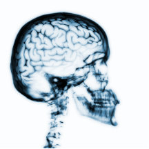 CEREBRO DEL CRÁNEO DE LA RADIOGRAFÍA - AZUL ESCULTURAS FOTOGRÁFICAS