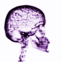 CEREBRO DEL CRÁNEO DE LA RADIOGRAFÍA - PÚRPURA ESCULTURA FOTOGRAFICA