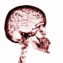CEREBRO DEL CRÁNEO DE LA RADIOGRAFÍA - ROJO ESCULTURAS FOTOGRÁFICAS