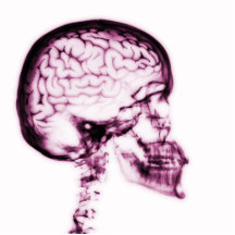 CEREBRO DEL CRÁNEO DE LA RADIOGRAFÍA - ROSA ESCULTURAS FOTOGRAFICAS