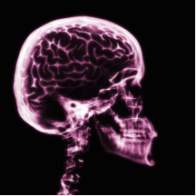 CEREBRO DEL CRÁNEO DE LA RADIOGRAFÍA - ROSA ESCULTURA FOTOGRÁFICA