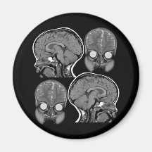 ¡CEREBROS! (MRI) IMANES DE NEVERA
