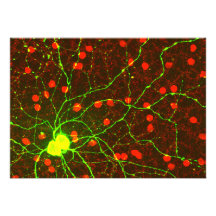Ciérrese encima de vista de la célula retiniana de comunicados