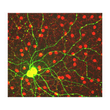Ciérrese encima de vista de la célula retiniana de impresiones en lienzo estiradas