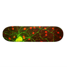 Ciérrese encima de vista de la célula retiniana de patín personalizado