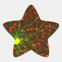 Ciérrese encima de vista de la célula retiniana de calcomanías forma de estrellaes