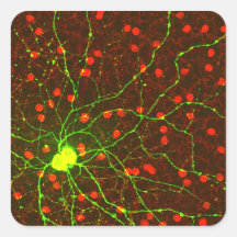 Ciérrese encima de vista de la célula retiniana de calcomanías cuadradases