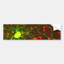 Ciérrese encima de vista de la célula retiniana de etiqueta de parachoque