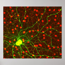 Ciérrese encima de vista de la célula retiniana de poster