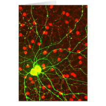 Ciérrese encima de vista de la célula retiniana de tarjetas