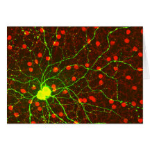 Ciérrese encima de vista de la célula retiniana de tarjeton