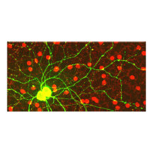 Ciérrese encima de vista de la célula retiniana de tarjetas fotográficas 