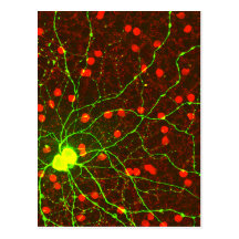 Ciérrese encima de vista de la célula retiniana de postales