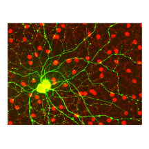 Ciérrese encima de vista de la célula retiniana de postal