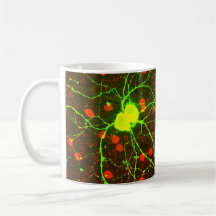 Ciérrese encima de vista de la célula retiniana de tazas de café