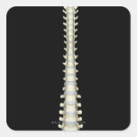 Columna vertebral 2 calcomanía cuadradas personalizadas
