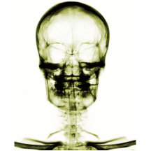 CRÁNEO ESQUELÉTICO DE VISION DE LA RADIOGRAFÍA - A ESCULTURAS FOTOGRAFICAS