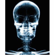 CRÁNEO ESQUELÉTICO DE VISION DE LA RADIOGRAFÍA - A ESCULTURAS FOTOGRAFICAS