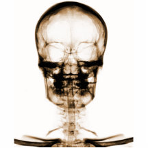 CRÁNEO ESQUELÉTICO DE VISION DE LA RADIOGRAFÍA - N ESCULTURAS FOTOGRÁFICAS