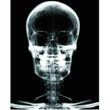 CRÁNEO ESQUELÉTICO DE VISION DE LA RADIOGRAFÍA - O ESCULTURAS FOTOGRÁFICAS