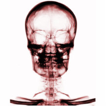 CRÁNEO ESQUELÉTICO DE VISION DE LA RADIOGRAFÍA - R ESCULTURA FOTOGRÁFICA