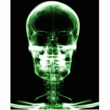 CRÁNEO ESQUELÉTICO DE VISION DE LA RADIOGRAFÍA - V ESCULTURAS FOTOGRÁFICAS
