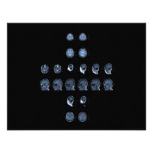 Cruz de MRI Comunicados