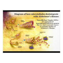 Desintegración de los Microtubules en enfermedad d Anuncios