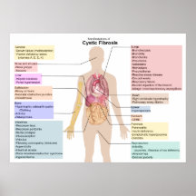 Diagrama de las manifestaciones de la fibrosis quí posters