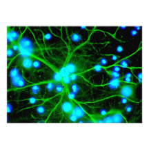 El Astrocyte es células de Glial asteroides en el  Anuncio