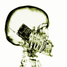ESQUELETO DE LA RADIOGRAFÍA EN EL TELÉFONO - AMARI ESCULTURAS FOTOGRÁFICAS