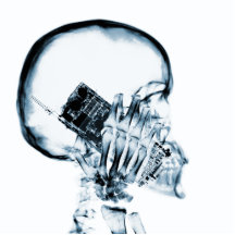 ESQUELETO DE LA RADIOGRAFÍA EN EL TELÉFONO - AZUL ESCULTURA FOTOGRAFICA