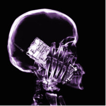 ESQUELETO DE LA RADIOGRAFÍA EN EL TELÉFONO - PÚRPU ESCULTURA FOTOGRAFICA