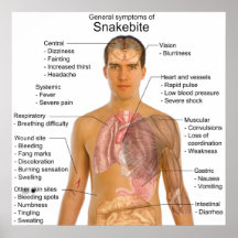 General Symtoms Chart de un envenenamiento del Sna Impresiones