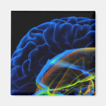 Imagen de la radiografía del cerebro iman