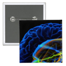 Imagen de la radiografía del cerebro pin
