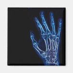 Imán azul de la radiografía de la mano