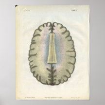 Impresión de la anatomía del cerebro humano impresiones