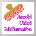 Malformación de Arnold Chiari Posters