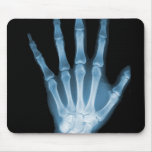 Mano azul del esqueleto de la radiografía tapete de raton